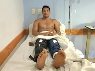 Un joven en La Plata fue a operarse la rodilla pero cuando despertó le habían intervenido las dos por error
