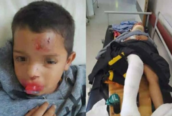 "Ojalá Dios cure ese corazón podrido que tenés": atropelló a un nene de 4 años en La Plata, huyó y la familia pide ayuda