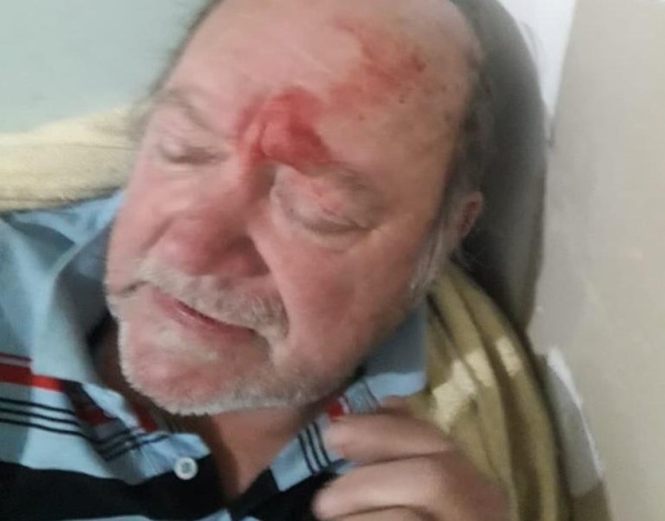 El jubilado que mató a un ladrón en Quilmes sufre un grave cuadro de hipertensión arterial