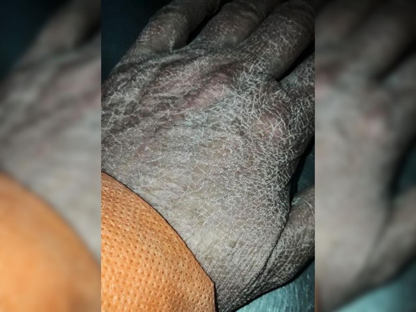 Impactante foto de las manos de una enfermera que se hizo viral: &quot;No importa, seguiremos, hay mucho camino por andar&quot;