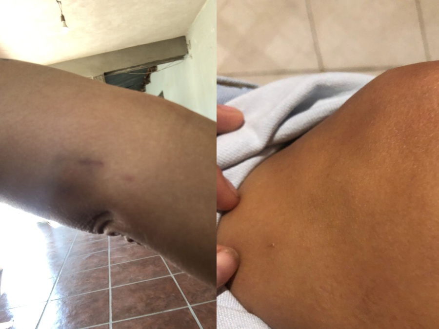 Una joven denuncia que fue maltratada por policías en La Plata: ”Me arrastraron y dejaron en corpiño”