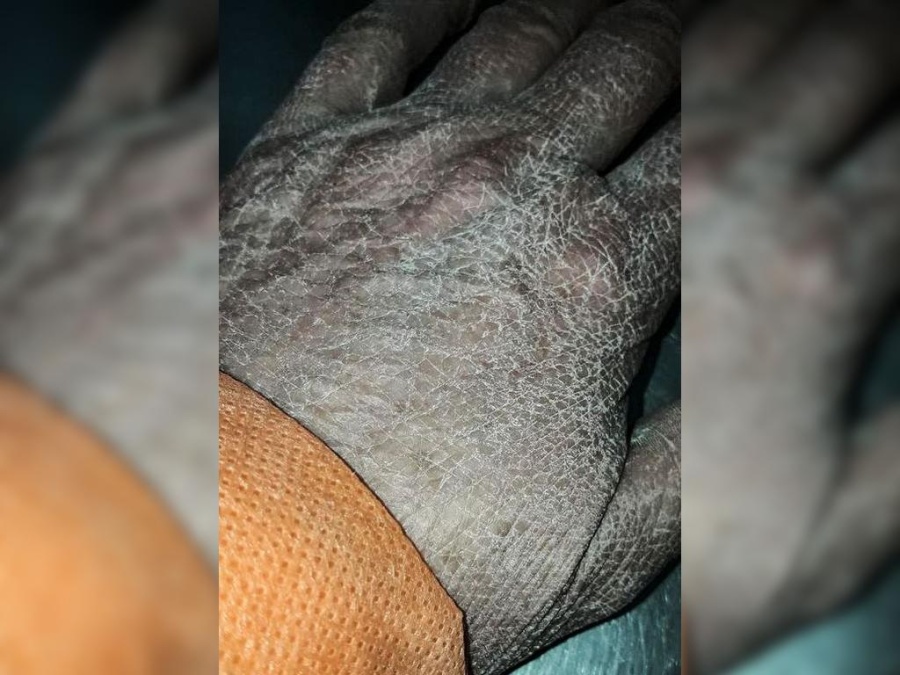 Impactante foto de las manos de una enfermera que se hizo viral: ”No importa, seguiremos, hay mucho camino por andar”